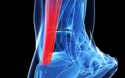 Achilles Tendinopathy and Rupture of the achilles tendon